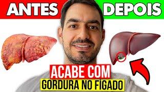 10 DICAS PARA REDUZIR A GORDURA NO FÍGADO (Esteatose hepática) | Dr Gustavo Duarte Pimentel