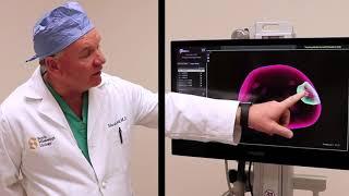 Dr. Mark Lyell on Early Prostate Cancer Detection with UroNav Technology