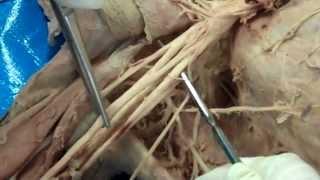 Brachial Plexus