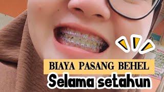 SETAHUN PAKAI BEHEL LANGSUNG RAPI / BIAYA PASANG BEHEL DI DOKTER SPC ORTHO