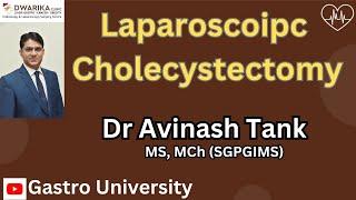 Gallbladder Treated by Laparoscopic Cholecystectomy Dr Avinash Tank Ahmedabad