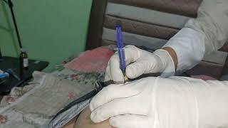 intramuscular injection 