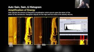 How to adjust the Gain & TVG on your Sonar