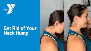 Get Rid of Your Neck Hump