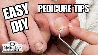 Beginner Pedicure Tutorial: Clean Yellow Toenails at Home #nails #satisfying