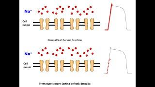 Mechanism of Brugada in a nutshell (English Version)