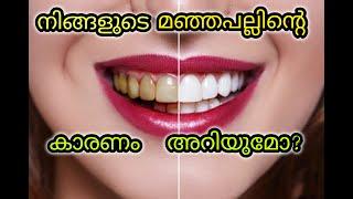 Reason for yellow teeth | why you have yellow teeth| Dr Ajina Salim Dentaltalk #drajinasalim #teeth