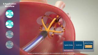 FARAPULSE™ Pulsed Field Ablation System Animation