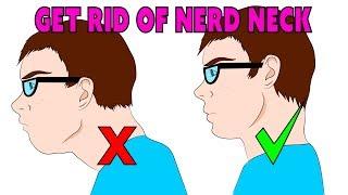 The 4 minute natural fix for forward head posture, nerd neck & anterior head carriage
