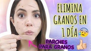 CÓMO QUITAR GRANOS EN 1 DÍA | What The Chic