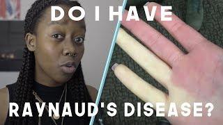 4 Signs You Have Raynaud's Disease | You Look Okay To Me