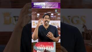 பல் சொத்தை ஒரு பல்லில் இருந்து எல்லாப் பல்லுக்கும் பரவுமா? Spreading tooth decay Dr.Karthikeyan