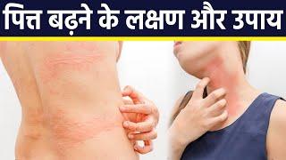 पित्त बढ़ने से शरीर में क्या होता है । पित्त दोष बढ़ने के लक्षण और उपाय । Expert Advice । Boldsky