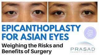 Epicanthoplasty for Asian Eyes - Risks and Benefits of Revealing More of the Inner Corners of Eyes