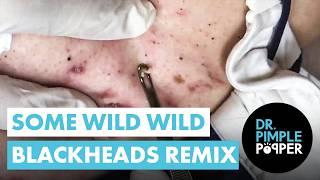 Some Wild Wild Blackheads Remix