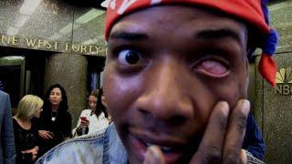 HOW HE LOST HIS LEFT EYE | FETTY WAP EXPLAINS