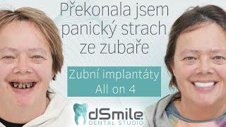 Zničené zuby kvůli strachu:Jak jsem změnila svůj život #dsmile#implant#dentist#allon4dentalimplants