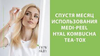 Medi-Peel Hyal Kombucha Tea-Tox Ampoule, Cream, Toner – отзыв и впечатления о новинке Меди Пил 2023