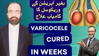 Say no to varicocele surgery , bilateral varicocele cured  with homeopathy with proof in Urdu/Hindi.