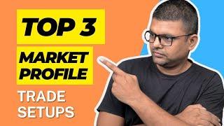 Top 3 Market Profile Trade Setups (You Can Use Today)