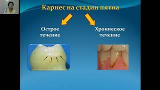 Кариес зубов  Этилогия, патогенез, классификация, клинические формы, дифференциальная диагностика