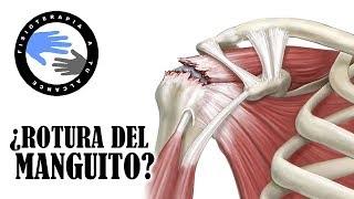 ¿Dolor de hombro? 3 test para saber si tu manguito rotador tiene una lesion o esta roto