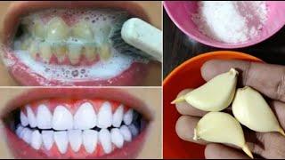 Teeth whitening at home in 2 minutes ||  How to naturally whiten your yellow teeth || 100% effective
