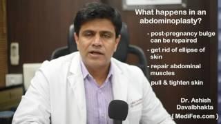 Abdominoplasty in India - Procedure, Cost and Recovery Time