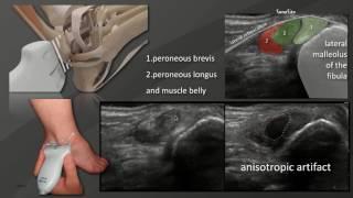 Webinar: Ultrasound Basics of the Foot and Ankle with Injections