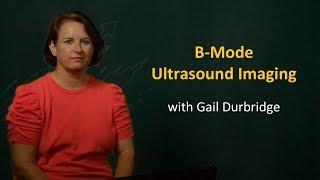 UQx Bioimg101x 4.2.5 B-Mode Ultrasound