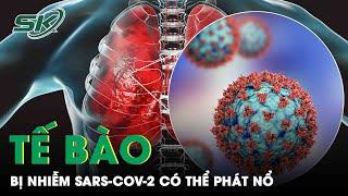 Nghiên Cứu Mới: Tế Bào Bị Nhiễm Virus SARS-Cov-2 Có Thể “Phát Nổ” Như Thế Nào? | SKĐS