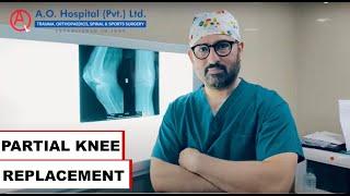 PARTIAL KNEE REPLACEMENT SURGERY BY DR.UMER BUTT