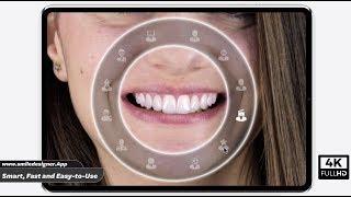 Smile Designer App 4K - AI Smile Design Software