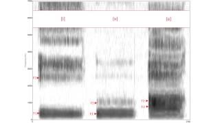 Phonetik und Phonologie der romanischen Sprachen