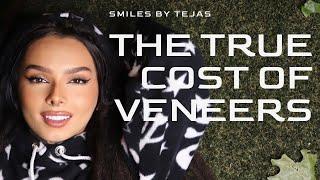 Discover the True Cost of Veneers