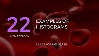 CBC Analyzer Part 6b - Examples of Histograms