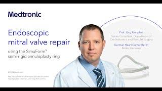 Sponsored Content: Endoscopic mitral valve repair using the SimuForm™ semi-rigid annuloplasty ring