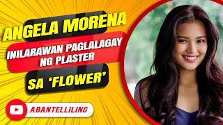 Angela Morena inilarawan paglalagay ng plaster sa ‘flower’