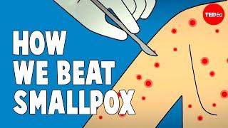 How we conquered the deadly smallpox virus - Simona Zompi