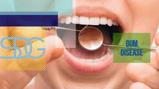 What is Gum Disease? | Spodak Dental Group