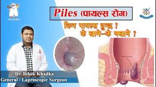 Piles -(पायल्स रोग) किन पायल्स हुन्छ ?  के खाने—के नखाने ? Dr. Bibek Khadka