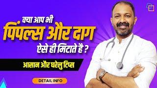 Pimples kaise hataye | How to get rid of acne | Detail info by Dr.Mayur sankhe | Beauty tips