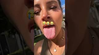 Does She Have Tongue Cancer?!