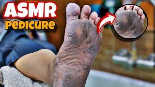 ASMR! pedicure Dirty Feet very especially and easily Scraps / cleanup feet / Footcare33 