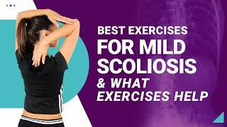 Best Exercises for Mild Scoliosis & What Exercises Help