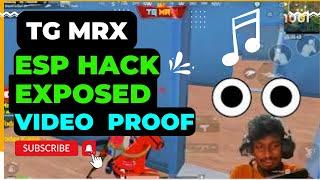 TG MrX ESP Hack Exposed with video Proof TGMrX hacker.