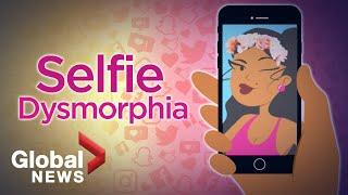 Selfie Dysmorphia: How social media filters are distorting beauty 