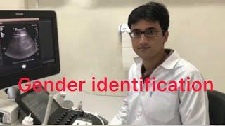 Sonography/ Gender identification in 12 weeks fetus