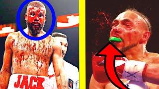 BLOODIEST Boxing Fights Of ALL TIME...