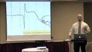 The 6 Causes ST Segment Elevation on an EKG/ ECG